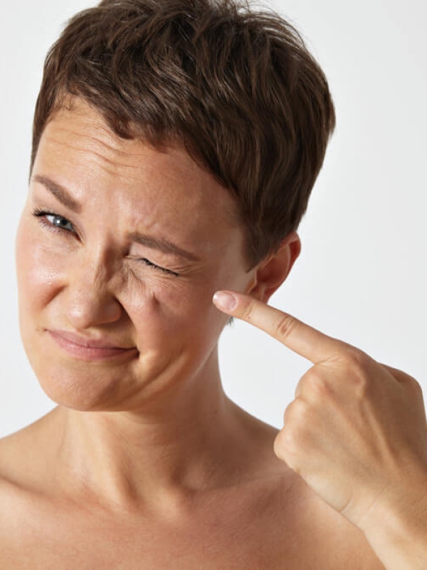 Mengenal Jerawat Menopause dan Cara Mengatasinya